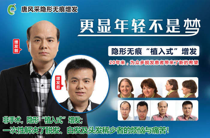 男士頭發(fā)稀少發(fā)型 唐風(fēng)采增發(fā)