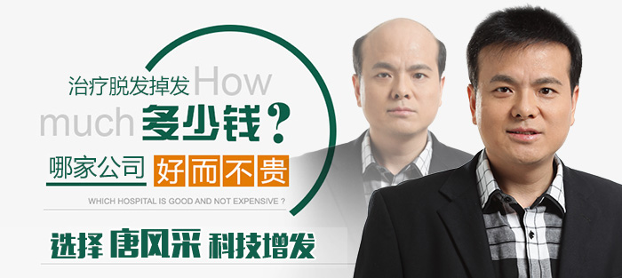 西寧哪有買(mǎi)假發(fā)的 唐風(fēng)采織發(fā)補(bǔ)發(fā)