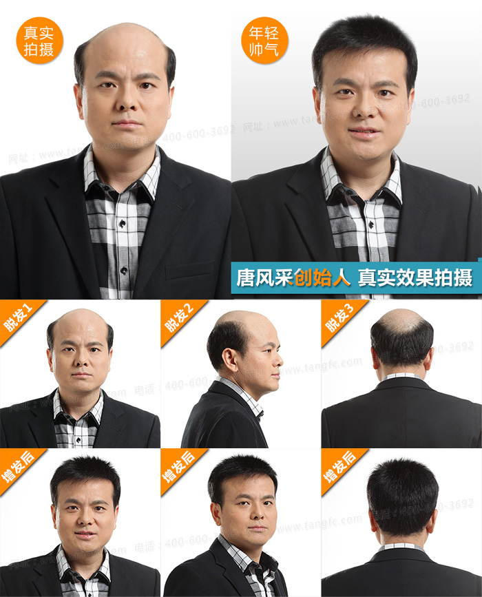 西寧哪有買(mǎi)假發(fā)的 唐風(fēng)采織發(fā)
