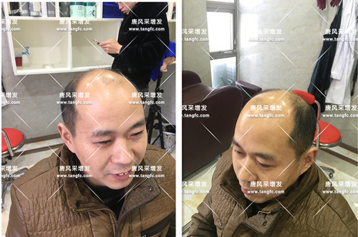 大叔增發(fā)魅力大增 大叔增發(fā)前