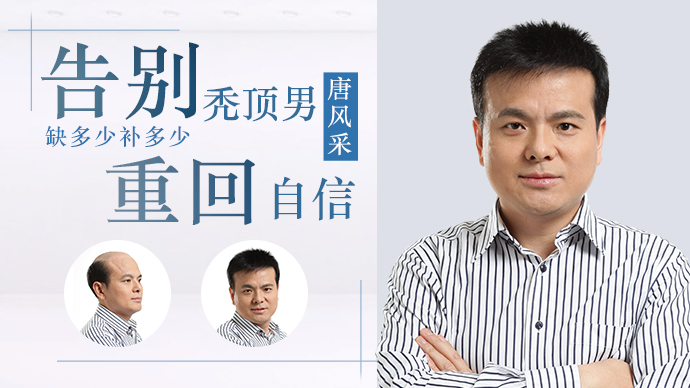 男士禿頂了 唐風(fēng)采織發(fā)補發(fā)