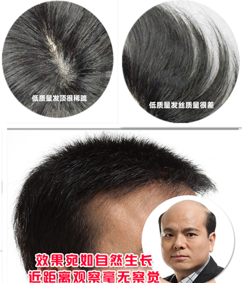 哈爾濱高檔假發(fā) 假發(fā)對比圖