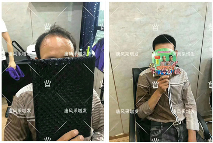 包頭哪里做真人假發(fā)的？真發(fā)都是從哪來的