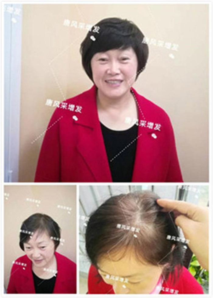 包頭假發(fā)什么牌子好 包頭假發(fā)什么牌子好?一定要選準(zhǔn)品牌精品