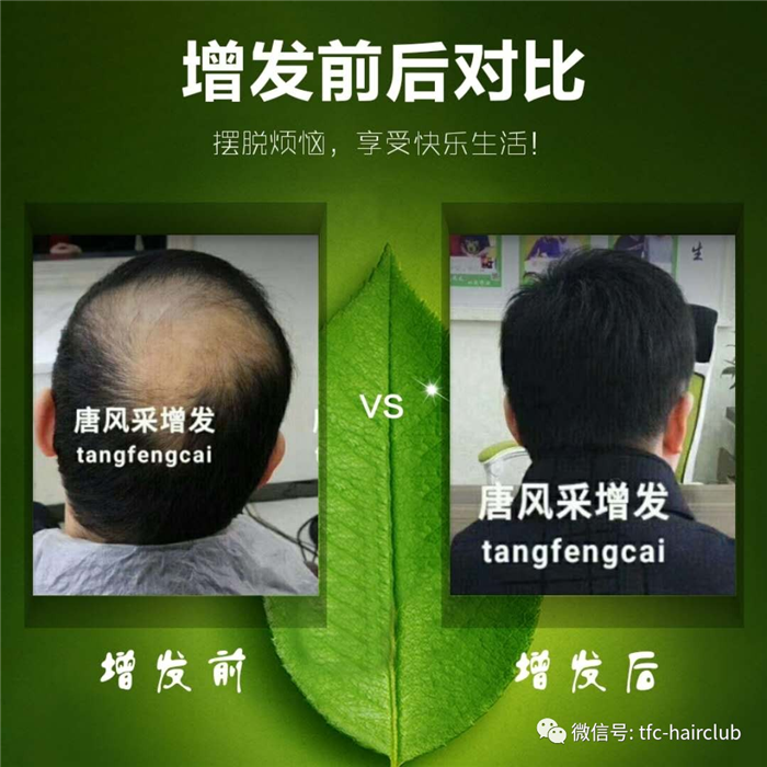 包頭哪里有真發(fā)假發(fā)套的專(zhuān)賣(mài)店？
