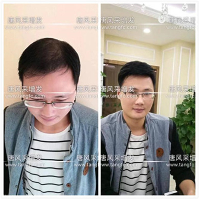 西安哪里有織發(fā)？看了你就會知道！