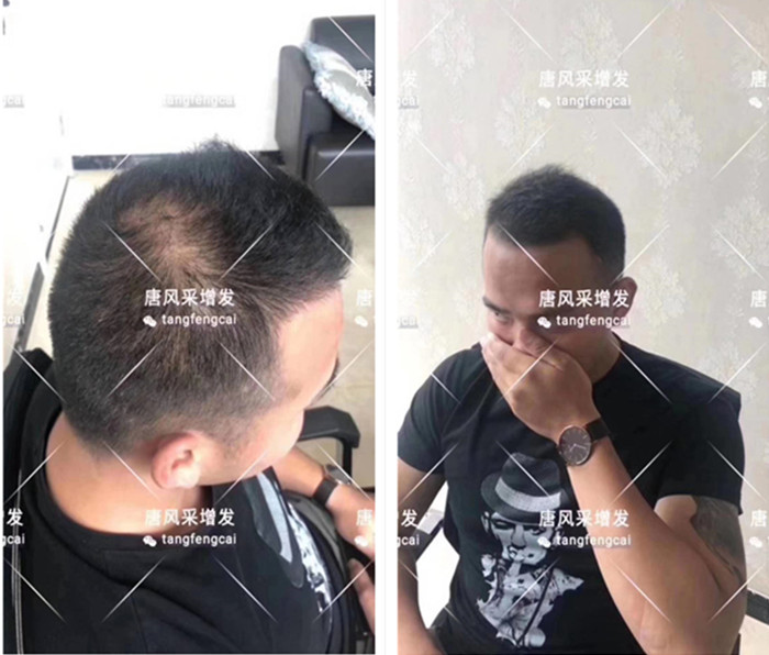 特朗普大背頭造型 唐風(fēng)采客戶增發(fā)對(duì)比圖