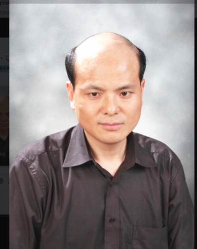 創(chuàng)始人唐利民 無痕增發(fā) 典型的脂溢性脫發(fā)