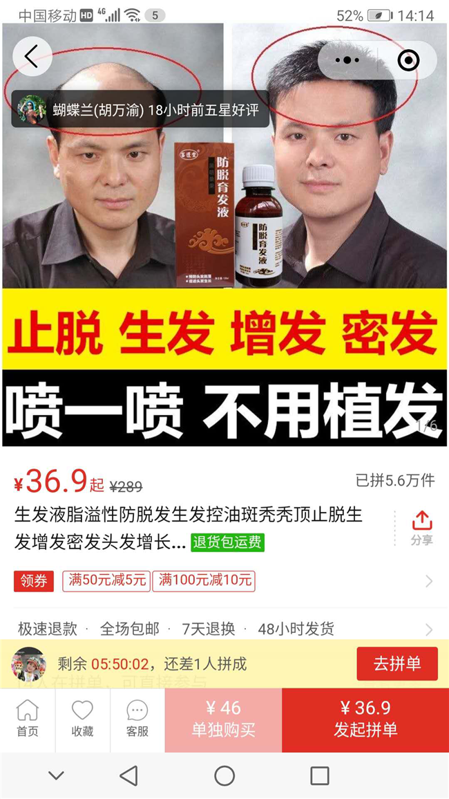 某品牌生發(fā)液。