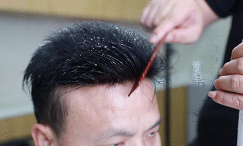 唐風(fēng)采無痕補發(fā)技術(shù) \