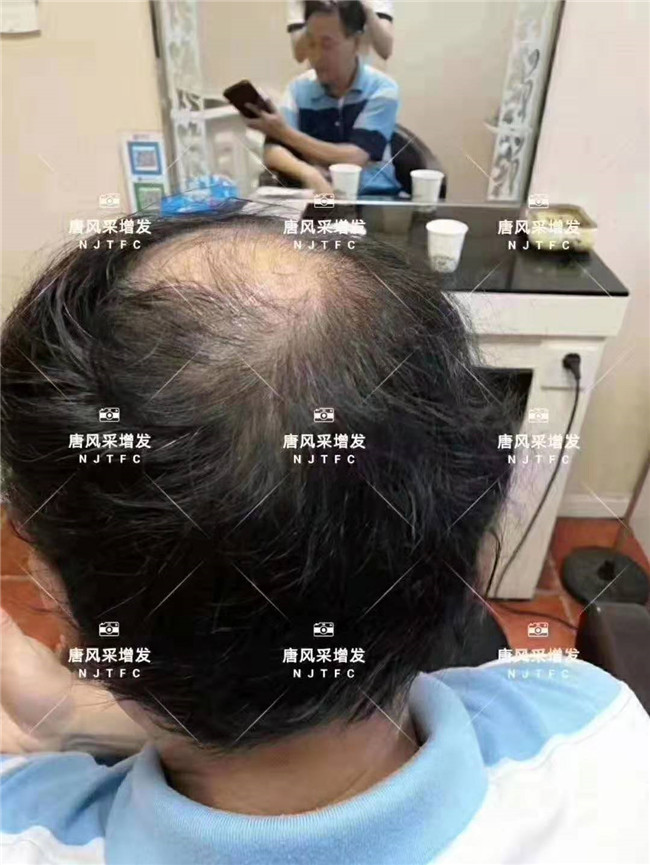 “地方支援中央”政策。