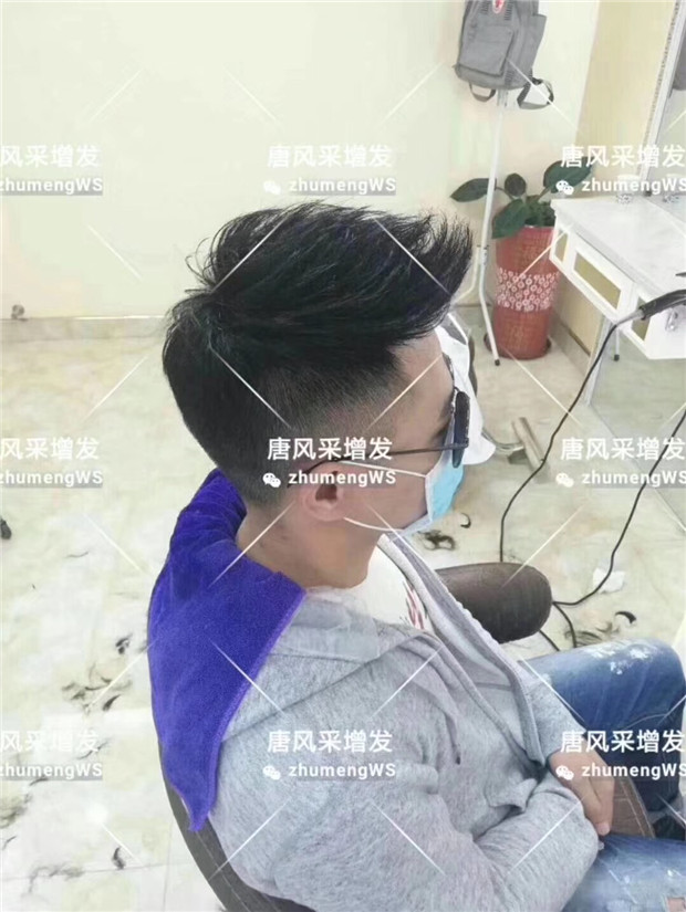 男士真發(fā)補(bǔ)發(fā)塊 唐風(fēng)采客戶案例小唐增發(fā)后