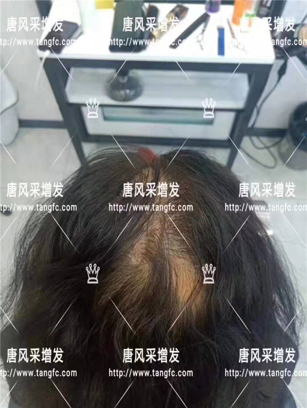 時(shí)尚假發(fā) 官方二維碼 唐風(fēng)采無痕假發(fā)
