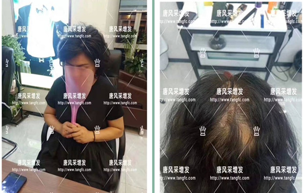 時(shí)尚假發(fā) 官方二維碼 客戶案例