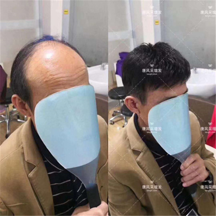 手鉤假發(fā) 唐風(fēng)采客戶案例分享篇