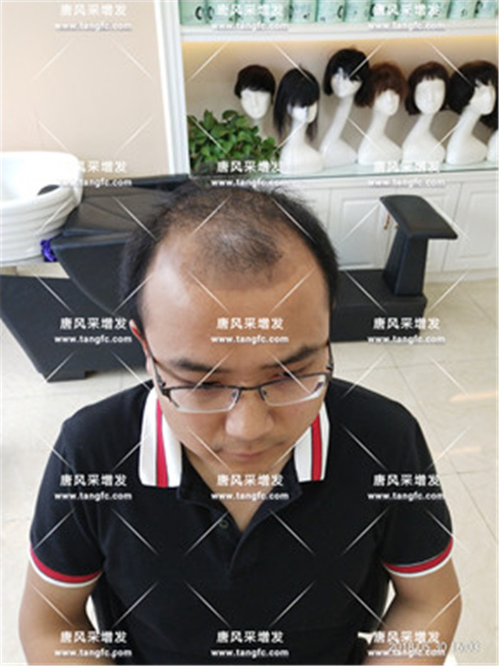 男明星假發(fā) 唐風采客戶案例