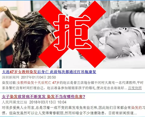 仿真假發(fā)專(zhuān)賣(mài)店 假發(fā)太差有哪些影響