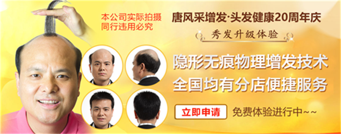 如何解決地中海脫發(fā) 唐風(fēng)采增發(fā)