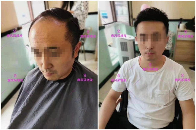 中老年頭頂假發(fā)片價(jià)格 唐風(fēng)采客戶