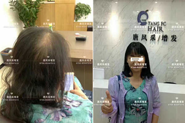 買(mǎi)假發(fā)哪個(gè)牌子好又便宜 唐風(fēng)采客戶案例