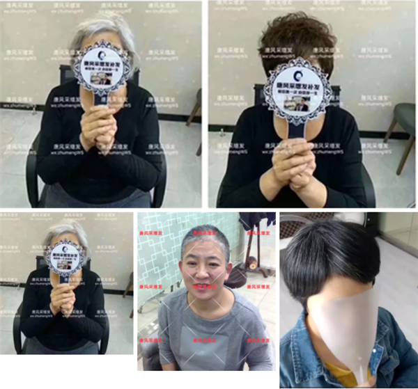 唐風采開展“關愛中老年健康”公益活動 唐風采活客戶案例——白頭發(fā)