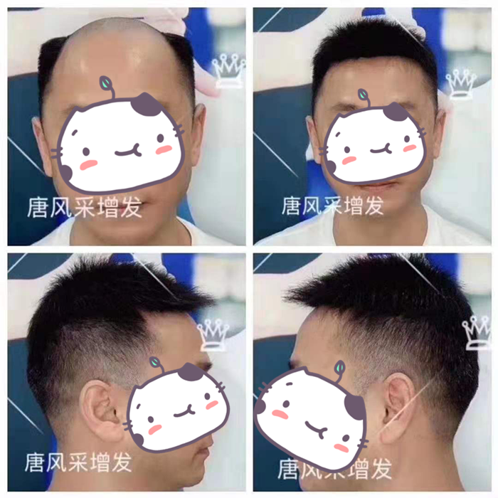 網(wǎng)上哪里買假發(fā)好 實體店可以觀察很多做工細節(jié)