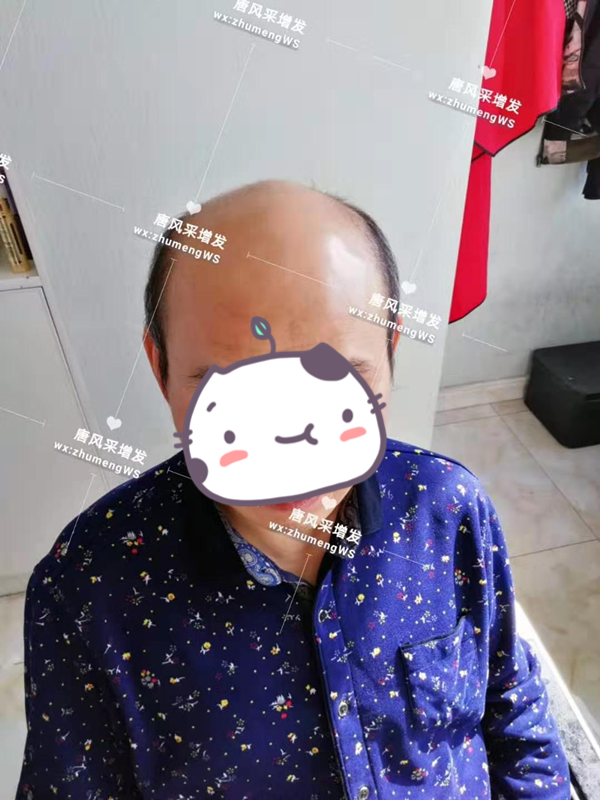 男用中老年真發(fā)假發(fā) 唐風(fēng)采客戶魏先生