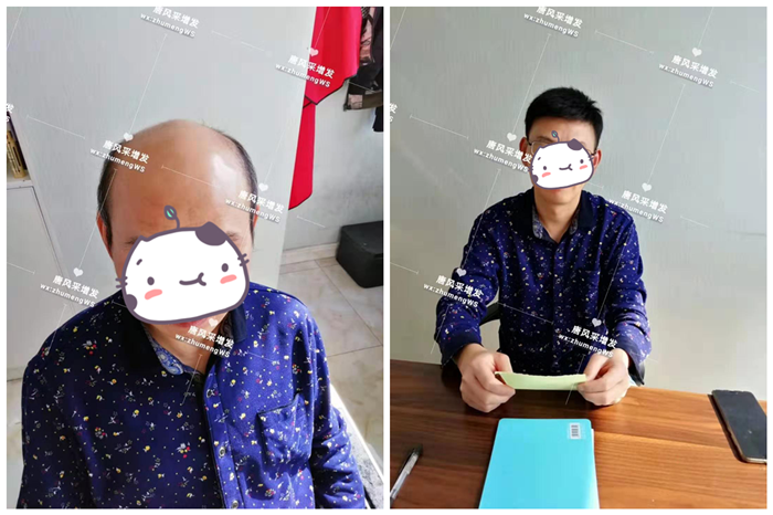 男用中老年真發(fā)假發(fā) 唐風(fēng)采客戶魏先生增發(fā)前后對(duì)比圖