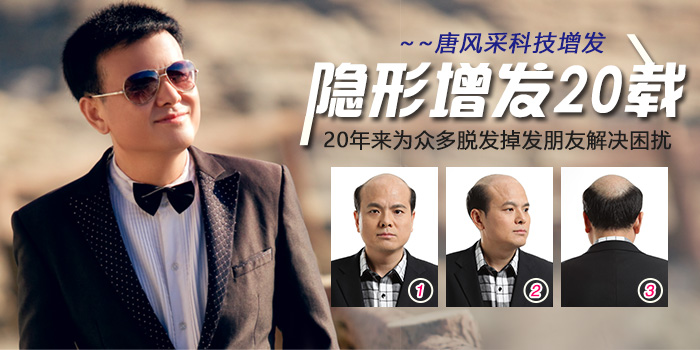 頭頂粘貼假發(fā)片 唐風(fēng)采黏貼式假發(fā)片深受發(fā)友喜愛