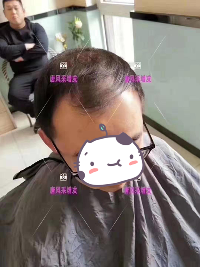 男士假發(fā)套 唐風(fēng)采客戶增發(fā)前