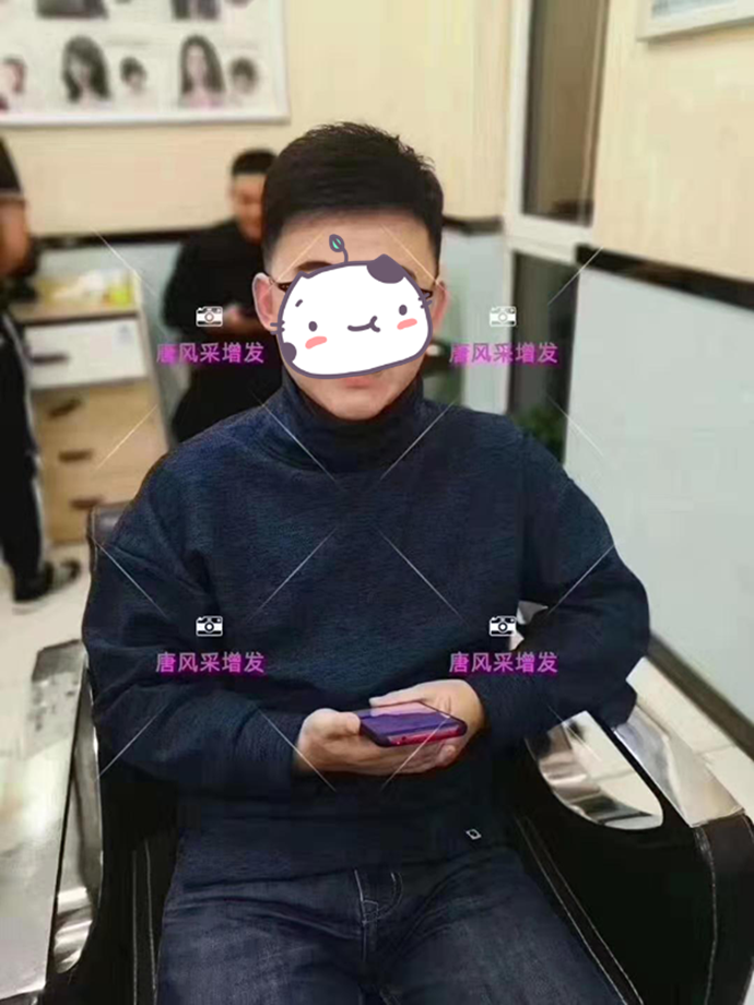 男士假發(fā)套發(fā)型 唐風(fēng)采客戶增發(fā)后