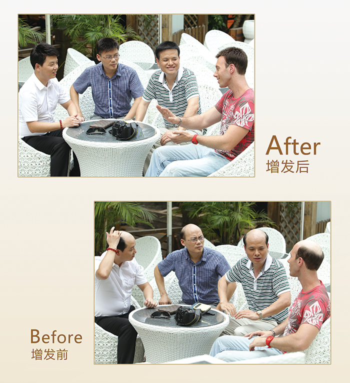 到哪里做的假發(fā) 脫發(fā)了可以戴假發(fā)