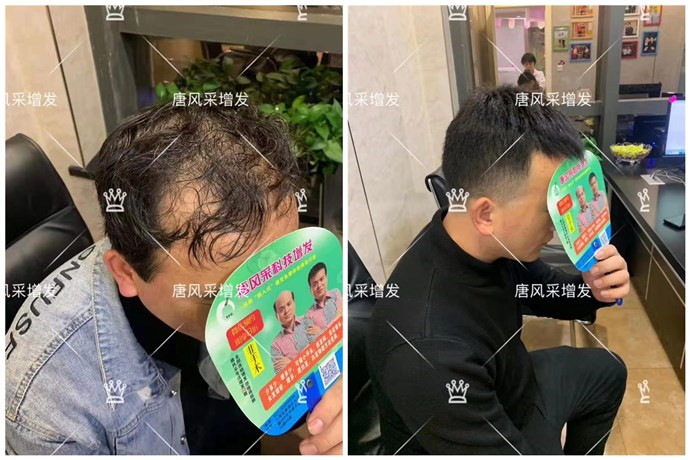 到哪里做的假發(fā) 唐風(fēng)采客戶案例