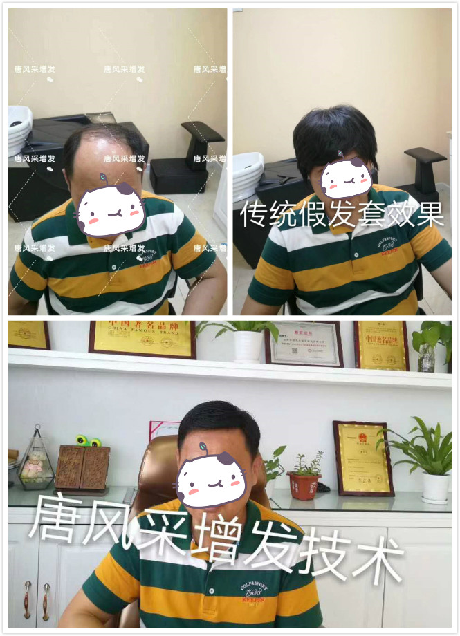 深圳假發(fā)店 傳統(tǒng)假發(fā)套跟定做假發(fā)的區(qū)別