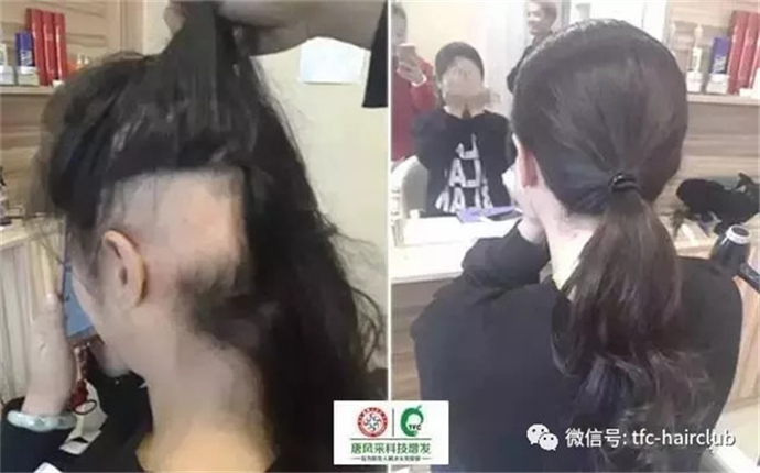 假發(fā)鬢角處怎么看著自然一點 量身定制假發(fā)的真實感