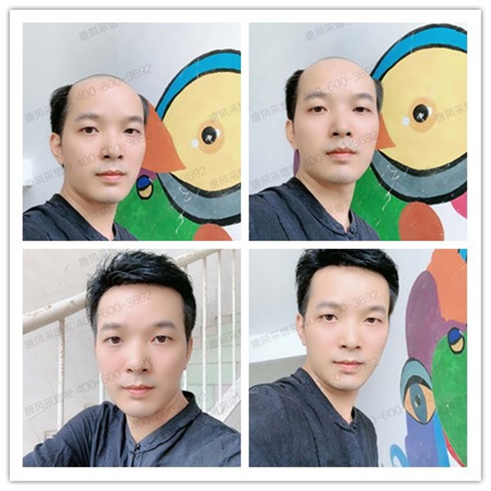 超級(jí)隱形發(fā)套 隱形自然