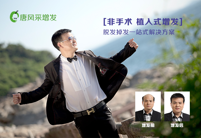 隱形發(fā)套 歡迎來(lái)電咨詢(xún)