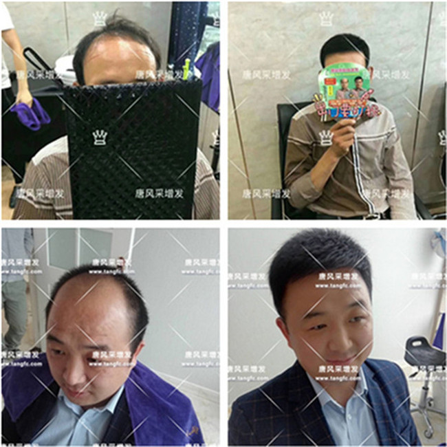 一個(gè)假發(fā)能用多久, 專業(yè)假發(fā)專賣店會提供護(hù)養(yǎng)服務(wù)