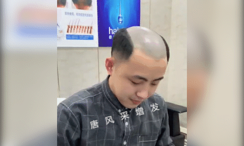 粘貼的假發(fā) 抖音上黏貼的假發(fā)