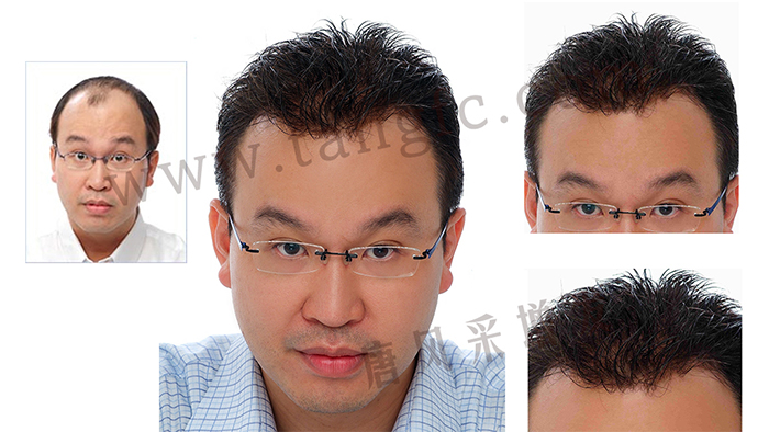 如果你hold不住謝頂，可以來試試真人頭發(fā)的假發(fā)