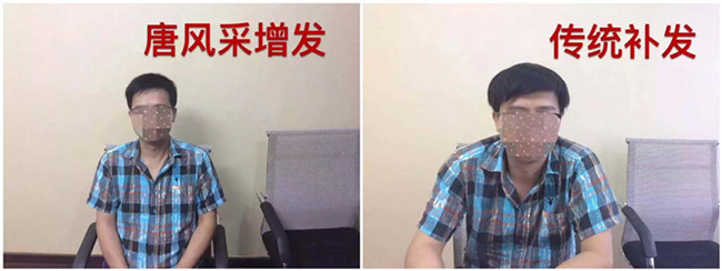 定制假發(fā) \