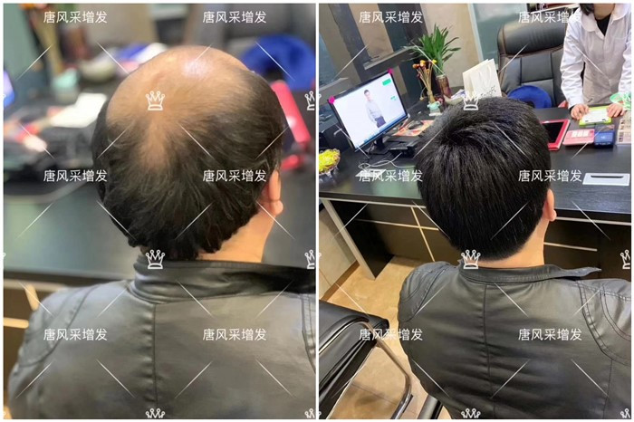 男士短發(fā)假發(fā) \