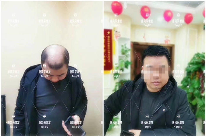 假發(fā)又薄又透氣 \