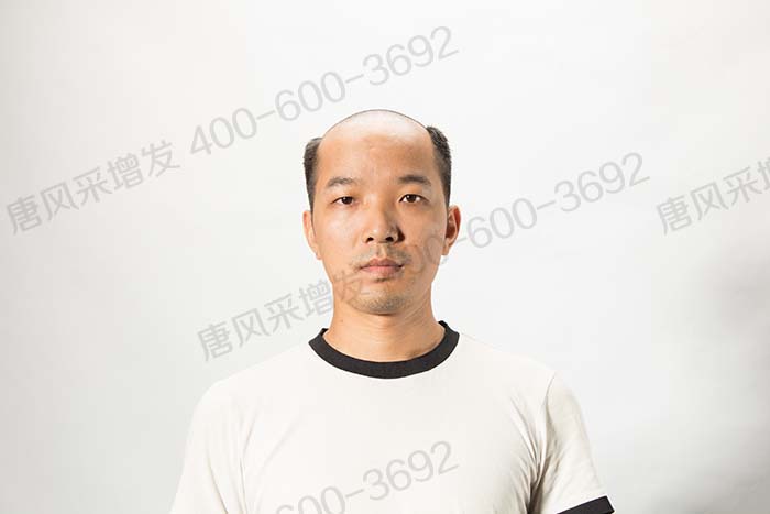 購買假發(fā) \