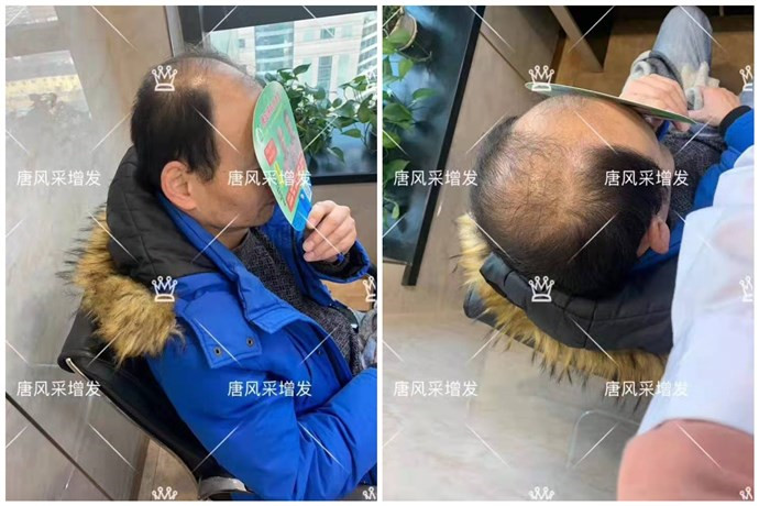 假發(fā)什么牌子質量好 \