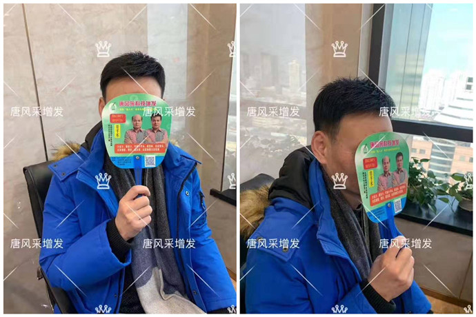 假發(fā)什么牌子質量好 \