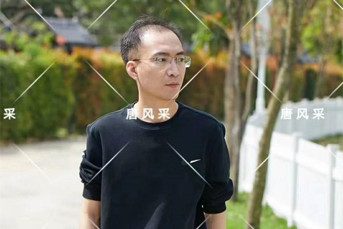 前額補發(fā)假發(fā)片 \