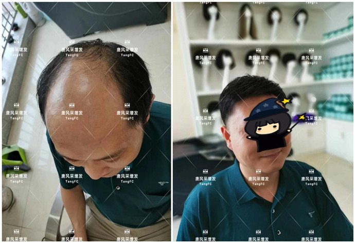 男士假發(fā)片 \