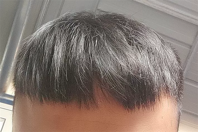 男士發(fā)套 \