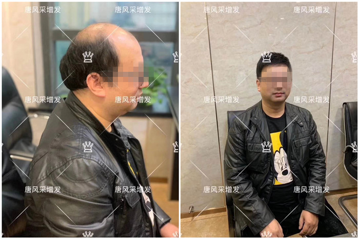 低端假發(fā) \